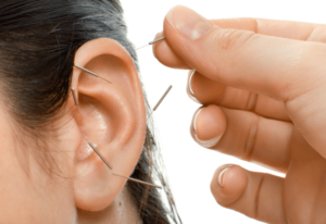 auricular acupuncture treatment is effective for many conditions that affect the body