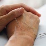 Flying Needle Medicine Acupuncture on Hands for Chronic Inflammation